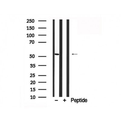 Western blot analysis of TRAF2 in lysates of HeLa, using TRAF2 Antibody(AF7863).