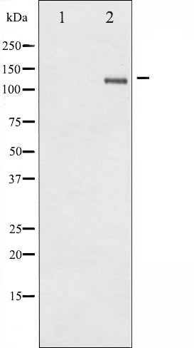 AF3283 at 1/100 staining Mouse lung tissue by IHC-P. The sample was formaldehyde fixed and a heat mediated antigen retrieval step in citrate buffer was performed. The sample was then blocked and incubated with the antibody for 1.5 hours at 22¡ãC. An HRP conjugated goat anti-rabbit antibody was used as the secondary