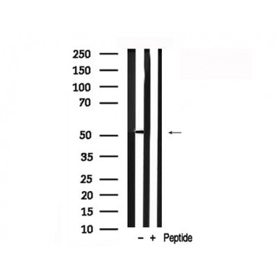 Western blot analysis of Mst1 in lysates of HeLa , using Mst1 Antibody(AF7866).