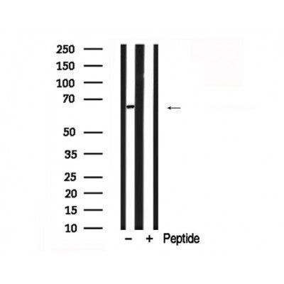 Western blot analysis of GRB10 in lysates of Jurkat , using GRB10 Antibody(AF7870).