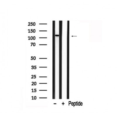 Western blot analysis of PLD1 in lysates of HepG2?, using PLD1 Antibody(AF7871).