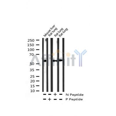 AF3284 staining Hela by IF/ICC. The sample were fixed with PFA and permeabilized in 0.1% Triton X-100,then blocked in 10% serum for 45 minutes at 25¡ãC. The primary antibody was diluted at 1/200 and incubated with the sample for 1 hour at 37¡ãC. An  Alexa Fluor 594 conjugated goat anti-rabbit IgG (H+L) Ab, diluted at 1/600, was used as the secondary antibod