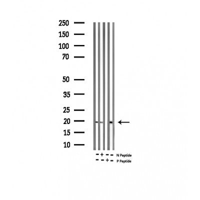 AF3285 at 1/200 staining Rat brain tissue sections by IHC-P. The tissue was formaldehyde fixed and a heat mediated antigen retrieval step in citrate buffer was performed. The tissue was then blocked and incubated with the antibody for 1.5 hours at 22¡ãC. An HRP conjugated goat anti-rabbit antibody was used as the secondary