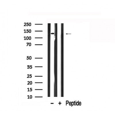 Western blot analysis of extracts of mouse brain tissue sample,using Pyk2 Antibody(AF7884).