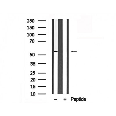 Western blot analysis of MEF2D in lysates of HepG2  , using MEF2D Antibody(AF7888).