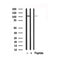 Western blot analysis of EPHA7 in lysates of NCI-H460, using EPHA7 Antibody(AF7893).