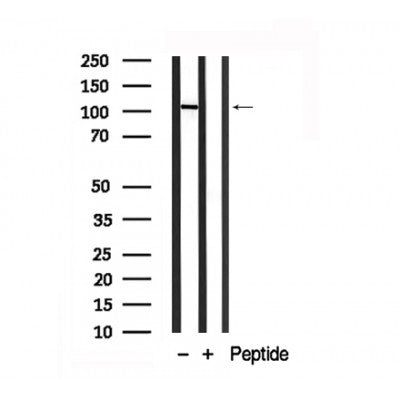 Western blot analysis of EPHA7 in lysates of NCI-H460, using EPHA7 Antibody(AF7893).