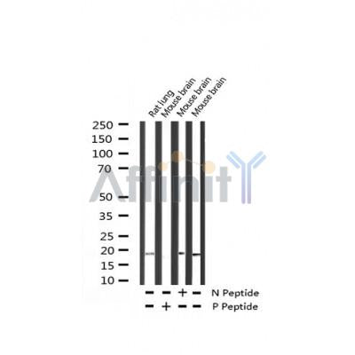 Western blot analysis of Phospho-Synuclein alpha (Tyr133) expression in various lysates