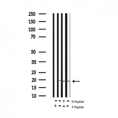 Western blot analysis of extracts from Hybridoma cells, using Phospho-Synuclein alpha (Tyr136) Antibody. Lane 1 was treated with the blocking peptide.