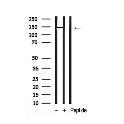 Western blot analysis of PAK2 in lysates of HeLa , using PAK2 Antibody(AF7906).