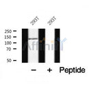 Western blot analysis of TBC1D1 in lysates of 293T, using TBC1D1 Antibody(AF7909).