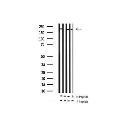 AF3288 at 1/100 staining human breast carcinoma tissue sections by IHC-P. The tissue was formaldehyde fixed and a heat mediated antigen retrieval step in citrate buffer was performed. The tissue was then blocked and incubated with the antibody for 1.5 hours at 22¡ãC. An HRP conjugated goat anti-rabbit antibody was used as the secondary