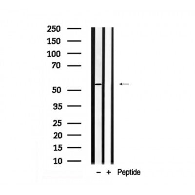 Western blot analysis of MLKL in lysates of HeLa , using MLKL Antibody(AF7920).