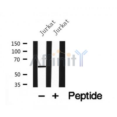 Western blot analysis of ERK8 in lysates of Jurkat, using ERK8 Antibody(AF7923).