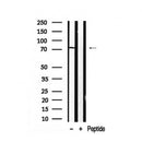 AF7925 at 1/100 staining human Prostate carcinoma tissue sections by IHC-P. The tissue was formaldehyde fixed and a heat mediated antigen retrieval step in citrate buffer was performed. The tissue was then blocked and incubated with the antibody for 1.5 hours at 22¡ãC. An HRP conjugated goat anti-rabbit antibody was used as the secondary