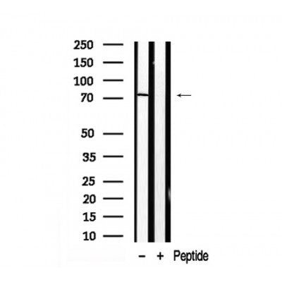 AF7925 at 1/100 staining human Prostate carcinoma tissue sections by IHC-P. The tissue was formaldehyde fixed and a heat mediated antigen retrieval step in citrate buffer was performed. The tissue was then blocked and incubated with the antibody for 1.5 hours at 22¡ãC. An HRP conjugated goat anti-rabbit antibody was used as the secondary