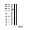 REPS1 Antibody