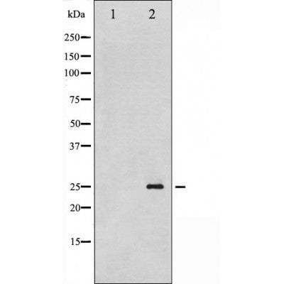 AF3290 staining HeLa by IF/ICC. The sample were fixed with PFA and permeabilized in 0.1% Triton X-100,then blocked in 10% serum for 45 minutes at 25¡ãC. The primary antibody was diluted at 1/200 and incubated with the sample for 1 hour at 37¡ãC. An  Alexa Fluor 594 conjugated goat anti-rabbit IgG (H+L) Ab, diluted at 1/600, was used as the secondary antibod