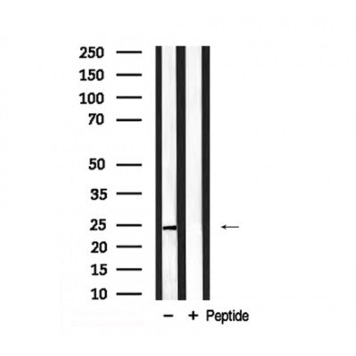 Western blot analysis of LIN28A in lysates of Neuro-2a?, using LIN28A Antibody(AF7938).