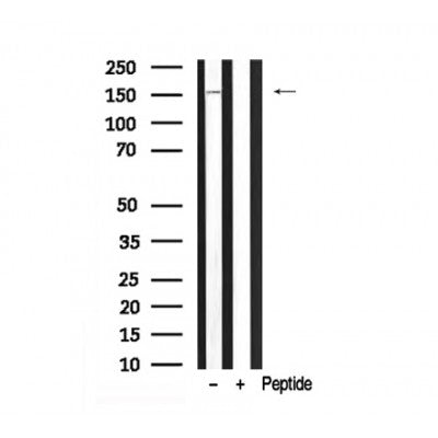 Western blot analysis of LATS2 in lysates of HeLa?, using LATS2 Antibody(AF7940).