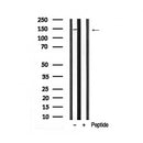 Western blot analysis of perk in lysates of HepG2?, using perk Antibody(AF7941).
