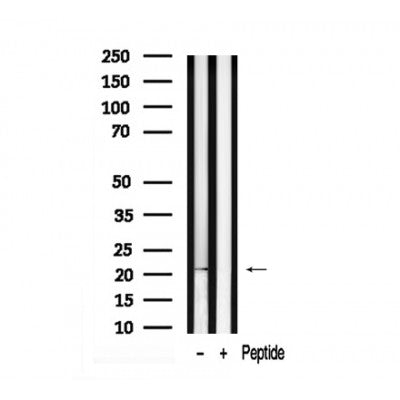 Western blot analysis of Twist1 in lysates of HEK-293T transfected with his-tagged Twist, using Twist1 Antibody(AF7945).