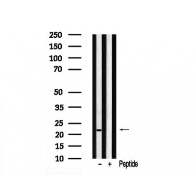 Western blot analysis of extracts of Human prostate tissue sample,using Claudin 7 Antibody .
