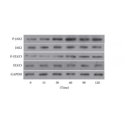 AF3294 staining LOVO by IF/ICC. The sample were fixed with PFA and permeabilized in 0.1% Triton X-100,then blocked in 10% serum for 45 minutes at 25¡ãC. The primary antibody was diluted at 1/200 and incubated with the sample for 1 hour at 37¡ãC. An  Alexa Fluor 594 conjugated goat anti-rabbit IgG (H+L) Ab, diluted at 1/600, was used as the secondary antibod