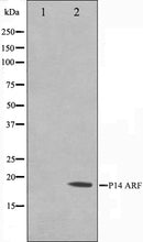 Western blot analysis on HeLa cell lysate using p14 ARF Antibody. The lane on the left is treated with the antigen-specific peptide.