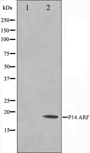 Western blot analysis on HeLa cell lysate using p14 ARF Antibody. The lane on the left is treated with the antigen-specific peptide.