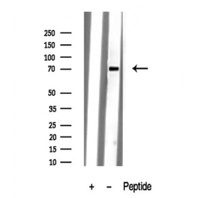 Western blot analysis of extracts of Mouse brain tissue sample,using Kv3.4/KCNC4 Antibody(DF10312).