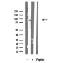 Western blot analysis of extracts of Mouse lung tissue sample,using Centaurin 1 Antibody(DF10313).
