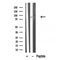 Western blot analysis of FGFR4 in lysates of Jurkat, using FGFR4 Antibody(DF10316).