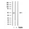 Western blot analysis of BCL-3 in lysates of HeLa?, using BCL-3 Antibody(DF10317).