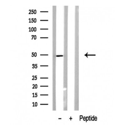 Western blot analysis of BCL-3 in lysates of HeLa?, using BCL-3 Antibody(DF10317).