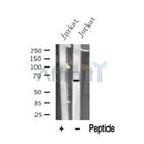 Western blot analysis of PNKP in lysates of Jurkat?, using PNKP Antibody(DF10318).