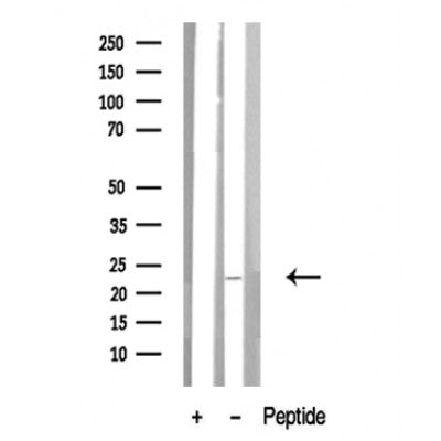 Western blot analysis of extracts of Mouse spleen tissue sample,using R-Ras Antibody(DF10319).