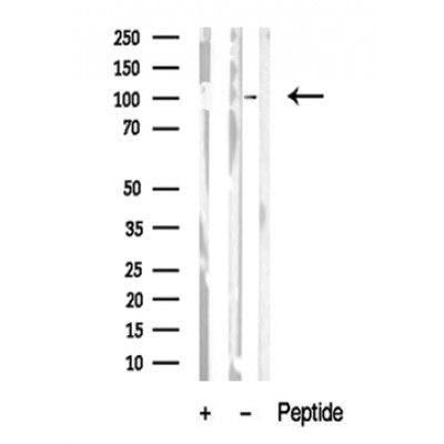 Western blot analysis of extracts of Mouse brain tissue sample,using CTIP Antibody(DF10321).