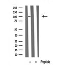 Western blot analysis of extracts of Mouse brain tissue sample,using RBBP8 Antibody(DF10324).