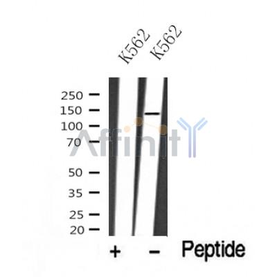 Western blot analysis of ABL1/2 in lysates of K562?, using ABL1/2 Antibody(DF10326).