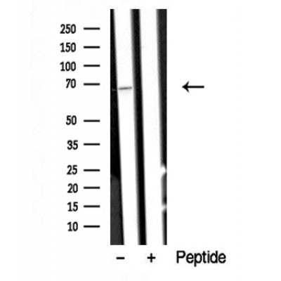 Western blot analysis of A-RAF in lysates of HeLa  , using A-RAF Antibody(DF10327).