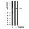 Western blot analysis of BRK in lysates of Jurkat?, using BRK Antibody(DF10328).