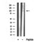 Western blot analysis of FER in lysates of Jurkat  , using FER Antibody(DF10332).