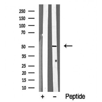 Western blot analysis of MST3 in lysates of HeLa?, using MST3 Antibody(DF10338).