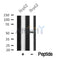 Western blot analysis of NDR1/2 in lysates of HepG2?, using NDR1/2 Antibody(DF10339).