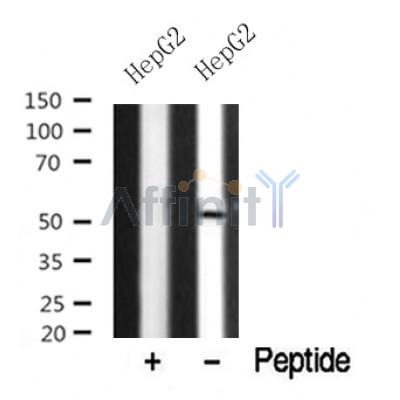Western blot analysis of NDR1/2 in lysates of HepG2?, using NDR1/2 Antibody(DF10339).