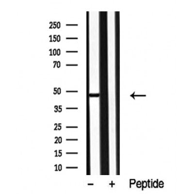 Western blot analysis of extracts of Human skeletal muscle tissue sample,using p38 / Antibody(DF10341).