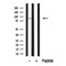 Western blot analysis of extracts of mouse adrenal? tissue sample,using SIK Antibody(DF10345).