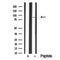 Western blot analysis of eIF2B in lysates of HeLa?, using eIF2B Antibody(DF10346).