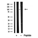 Western blot analysis of extracts of Human skeletal muscle? tissue sample,using DAG1 Antibody(DF10349).